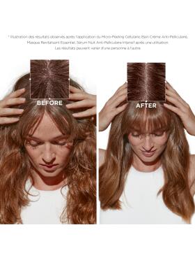 Kérastase Symbiose Bain Crème Anti-Pelliculaire Shampoo 250 ml