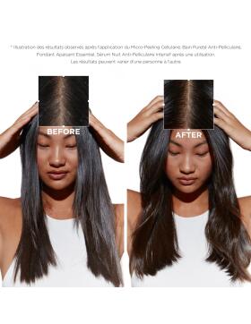 Kérastase Symbiose Bain Pureté Anti-Pelliculaire Shampoo 250 ml