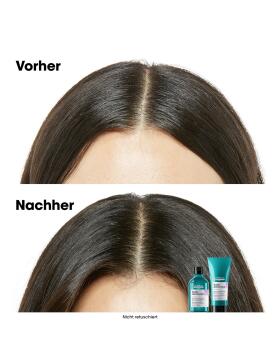 LOréal Professionnel Scalp Advanced Anti-Discomfort Dermo-regulator Shampoo 300 ml