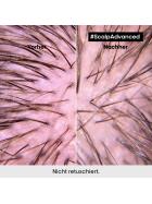 LOréal Professionnel Scalp Advanced Anti-Discomfort Intense Soother Treatment 200 ml